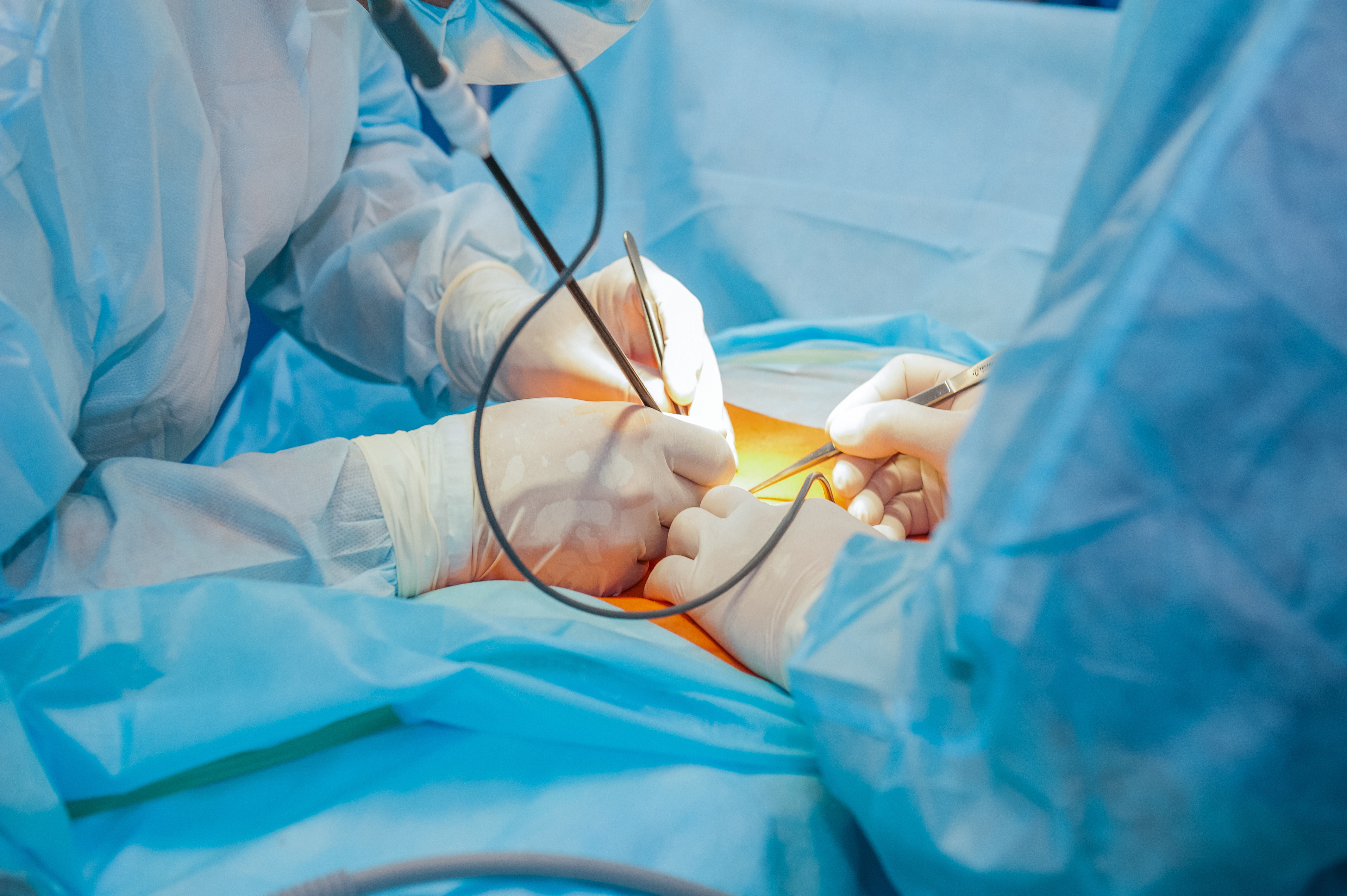 Abdominal Surgery - Dr Clay Albrecht