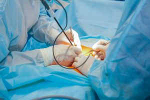 Complex laparoscopic operation