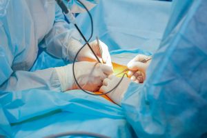 complex laparoscopic operation