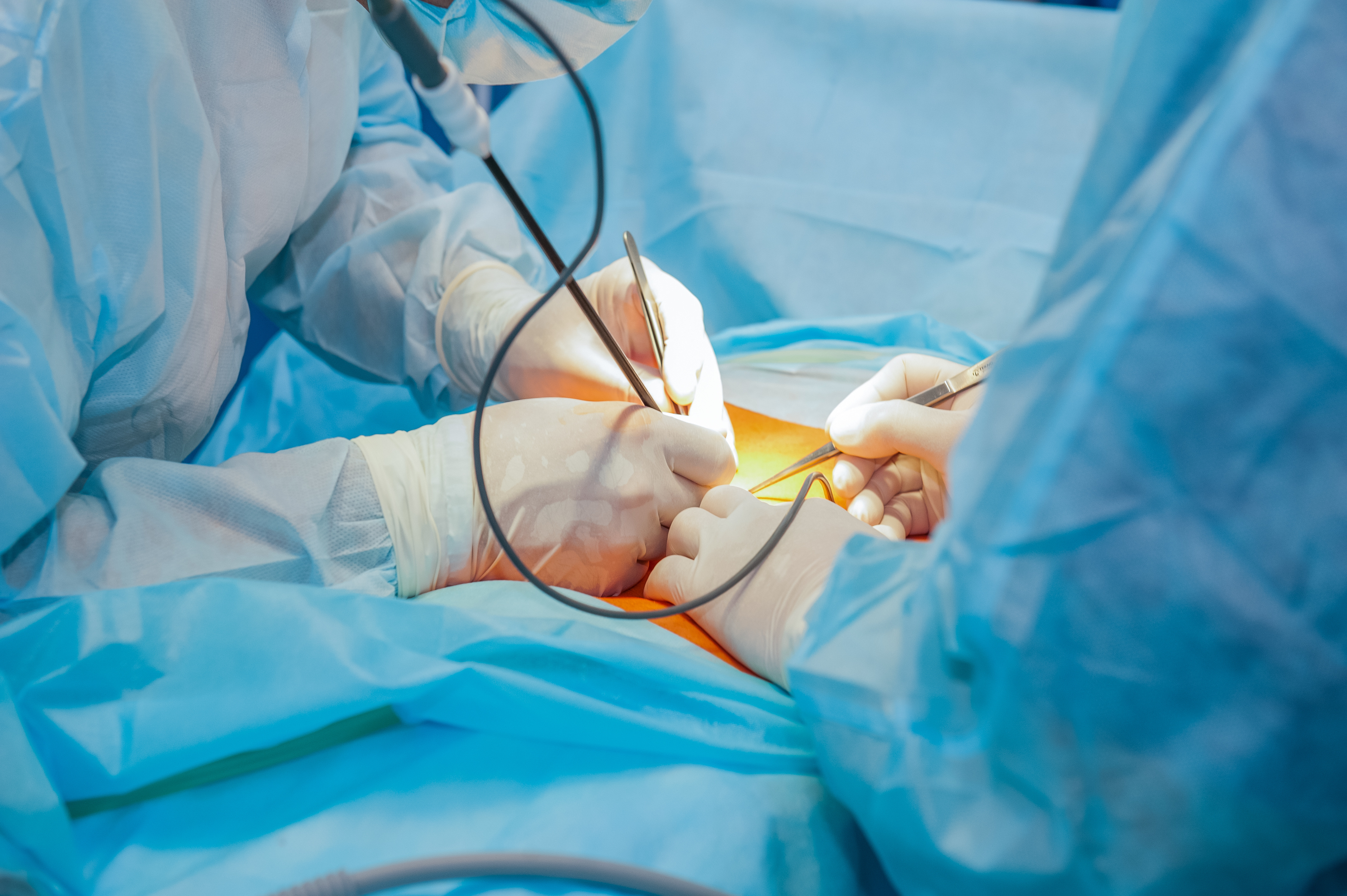 Abdominal Surgery -  Dr Clay Albrecht
